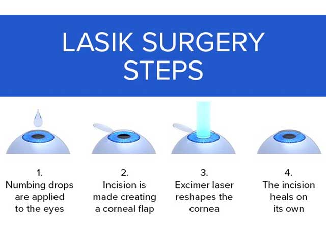 laser-eye-surgery-india
