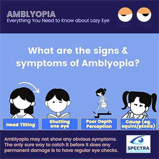 Lazy Eye Treatment (Amblyopia) In Kolkata, India | Causes, Symptoms, Surgery